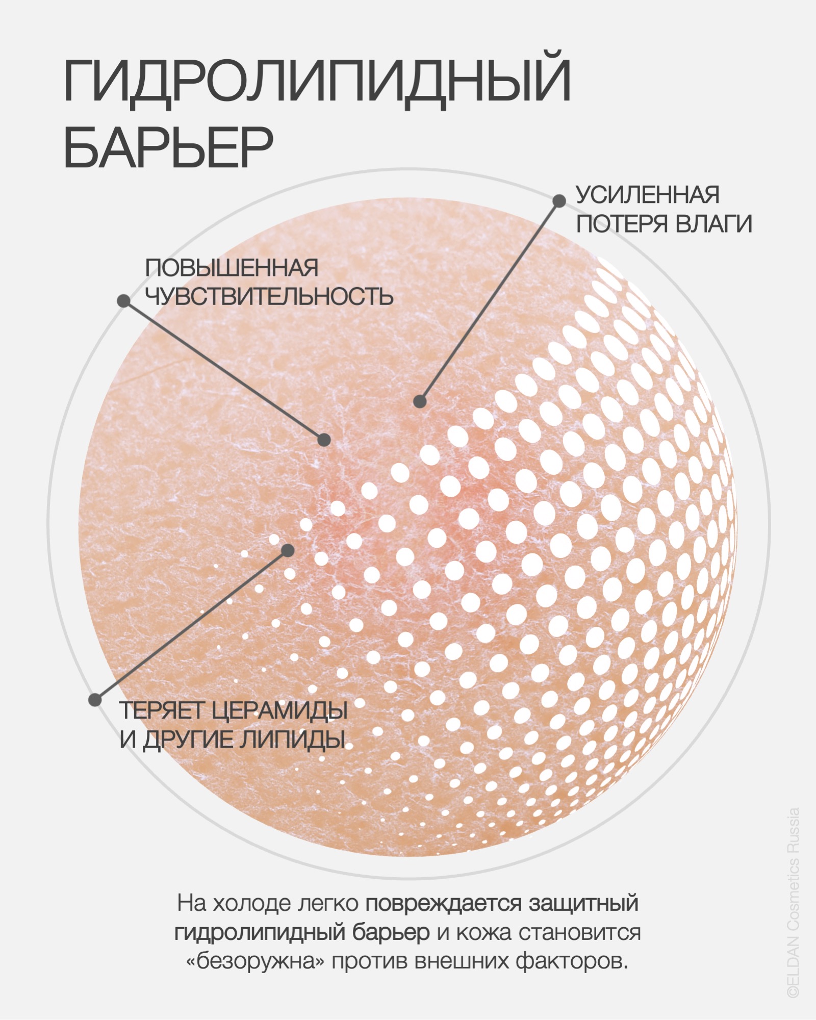 Пост краснота зимой 3.jpg